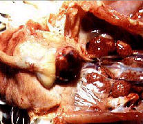 IBD에 감염된 닭의 신장과 F낭의종대 및 출혈