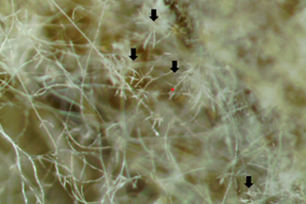Fusarium sp.1 사진
